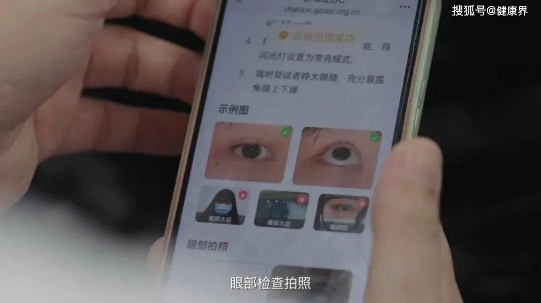 泛亚电竞app创新驱动ChatZOC为眼科诊疗带来的一场深刻变革(图2)